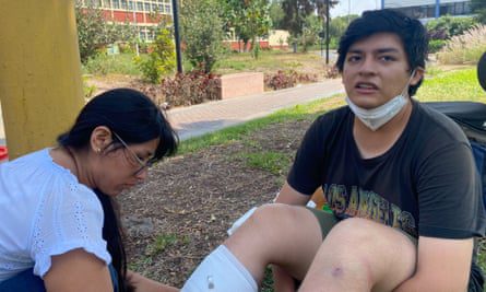 Esteban Godofredo, estudiante, está siendo atendido por una lesión en la pierna